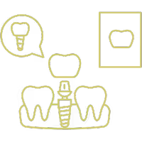 profesjonalne wszczepianie korony na implant zębowy